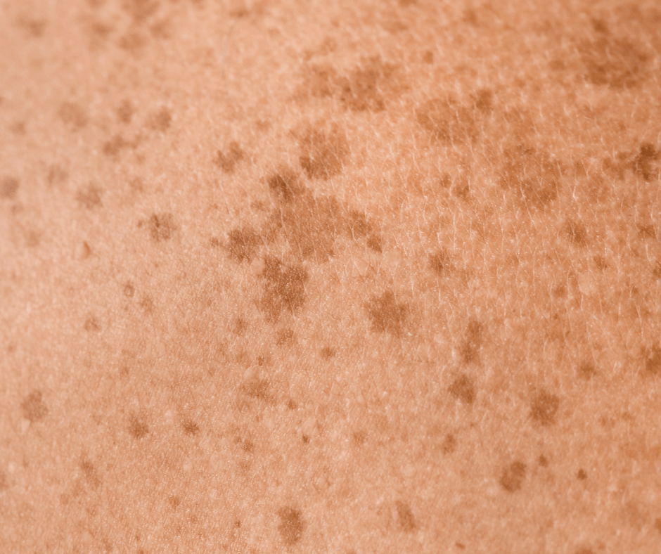 Innovación japonesa para reducir manchas - KOEN JAPAN BEAUTY