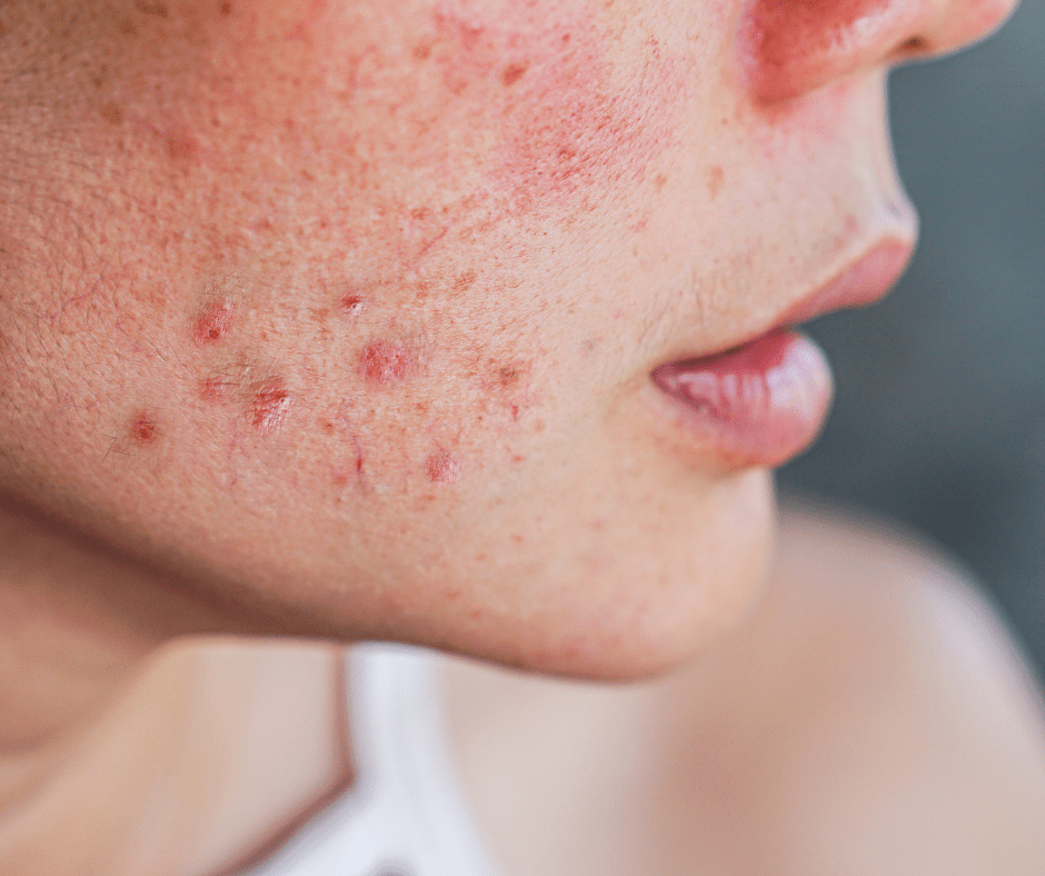 Los Mejores Ingredientes Japoneses para Piel Sensible - KOEN JAPAN BEAUTY